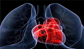 心肌缺血是什么原因造成的？