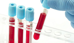最新血液检测法可以揭晓人体生理年龄