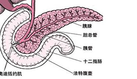 胰腺炎后要防糖尿病 一定要重视血糖变化