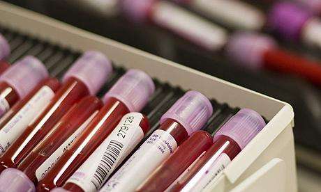 血检可测人体生物钟 预防多种致命疾病