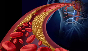 高胆固醇危害血管！如何保持血管健康？