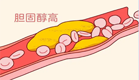 为什么体检要查胆固醇，胆固醇异常的诱因。